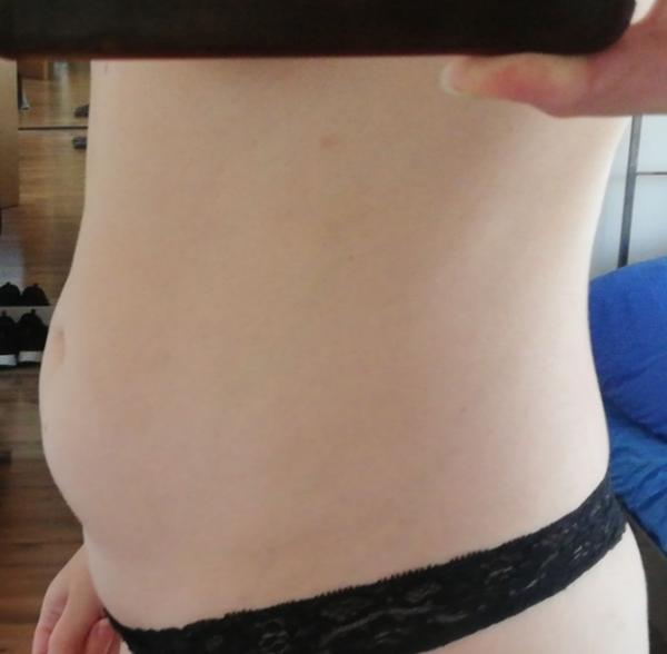Bild zu SSW18+1 komischer Bauch? - Schwanger - wer noch? Rund um die Schwangerschaft