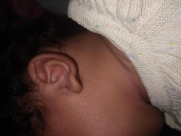 Bild zu Baby 3 Monate Ohrläppchen - Schwanger - wer noch? Rund um die Schwangerschaft