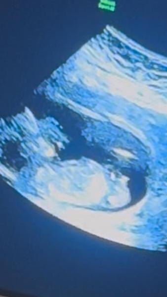 Bild zu Junge oder Mädchen – was denkt ihr? 😊 - Schwanger - wer noch? Rund um die Schwangerschaft