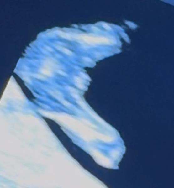 Bild zu Junge oder Mädchen – was denkt ihr? 😊 - Schwanger - wer noch? Rund um die Schwangerschaft