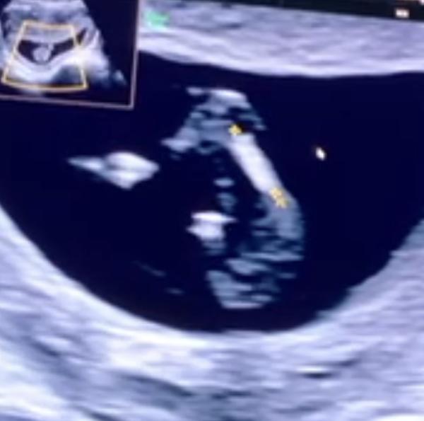 Bild zu Junge oder Mädchen – was denkt ihr? 😊 - Schwanger - wer noch? Rund um die Schwangerschaft