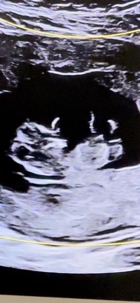 Bild zu Nub Theorie - Schwanger - wer noch? Rund um die Schwangerschaft