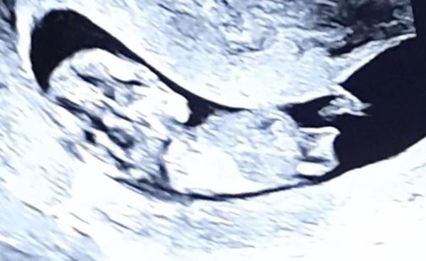 Bild zu Nub-Theorie Geschlecht - Schwanger - wer noch? Rund um die Schwangerschaft