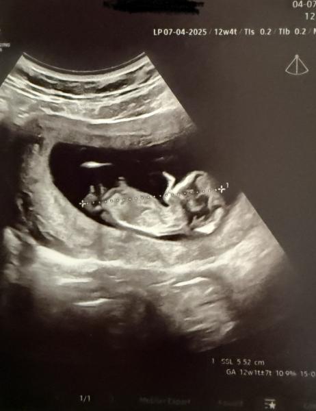 Bild zu NUB Theorie - Schwanger - wer noch? Rund um die Schwangerschaft