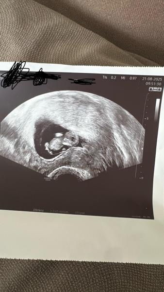 Bild zu Junge oder Mädchen - Schwanger - wer noch? Rund um die Schwangerschaft
