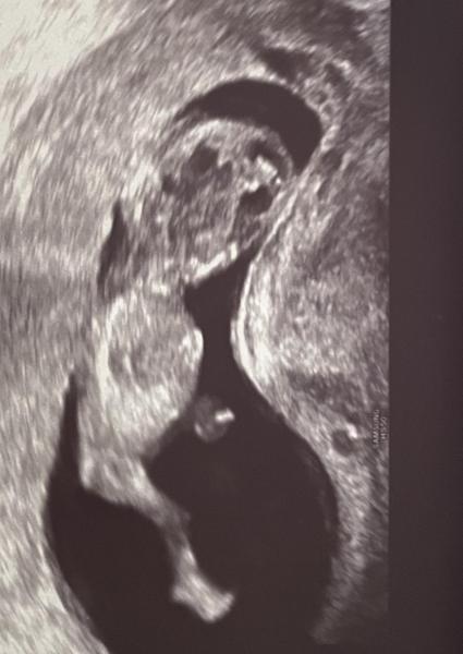 Bild zu Mädchen oder Junge ? 🌸🦋 - Schwanger - wer noch? Rund um die Schwangerschaft