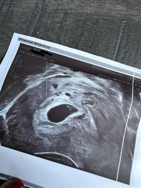 Bild zu SCHWANGER - Bitte um eure Meinung - Schwanger - wer noch? Rund um die Schwangerschaft