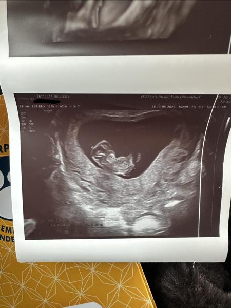 Bild zu Ultraschallbilder und SSL 10+0…. - Schwanger - wer noch? Rund um die Schwangerschaft