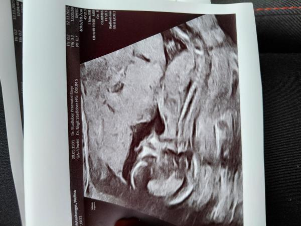 Bild zu Nub theorie - Schwanger - wer noch? Rund um die Schwangerschaft