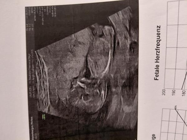 Bild zu Nub theorie - Schwanger - wer noch? Rund um die Schwangerschaft