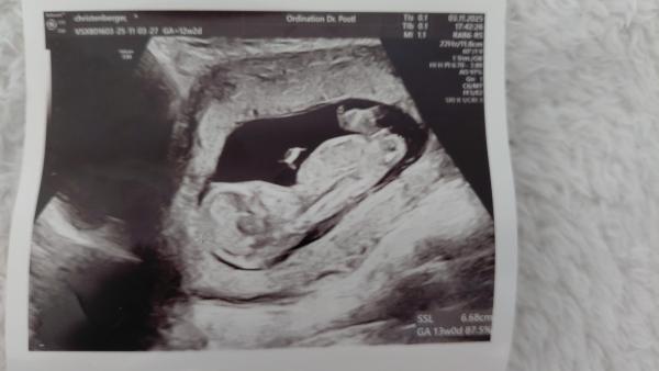 Bild zu Nub theorie - Schwanger - wer noch? Rund um die Schwangerschaft