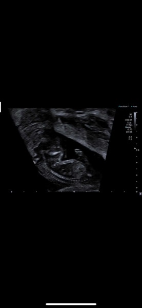 Bild zu Mädchen oder Junge? :-) - Schwanger - wer noch? Rund um die Schwangerschaft