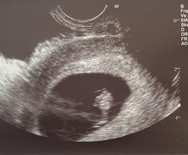 Bild zu Ramzi Methode - Schwanger - wer noch? Rund um die Schwangerschaft