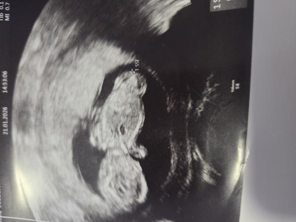 Bild zu Geschlecht - Schwanger - wer noch? Rund um die Schwangerschaft