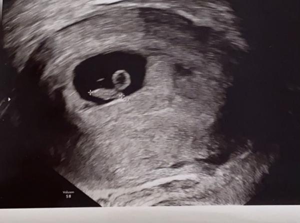 Bild zu Ramzi Methode Junge oder Mädchen - Schwanger - wer noch? Rund um die Schwangerschaft