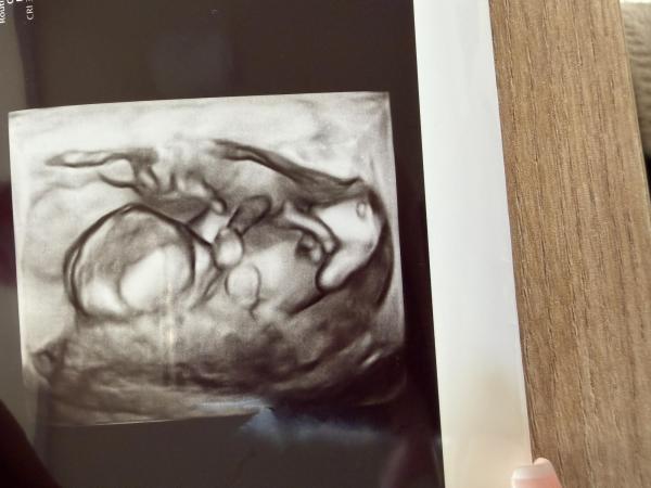 Bild zu Mädchen oder Junge - Schwanger - wer noch? Rund um die Schwangerschaft