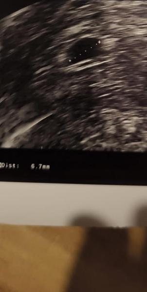 Bild zu Fruchthöhle leer - Schwanger - wer noch? Rund um die Schwangerschaft