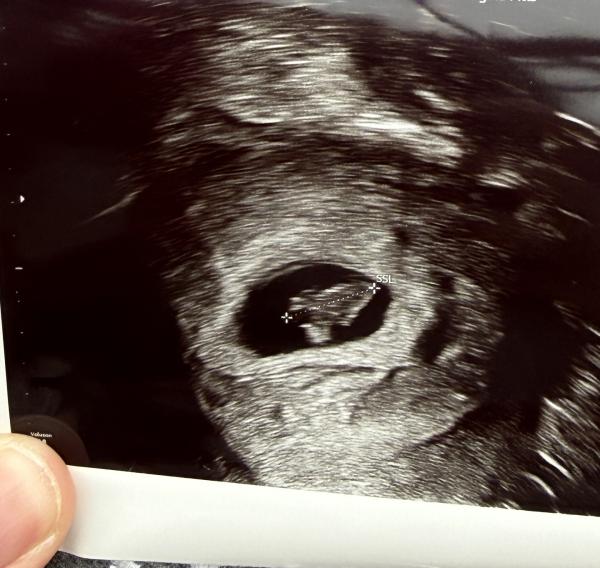 Bild zu Ramzi Methode Junge oder Mädchen - Schwanger - wer noch? Rund um die Schwangerschaft