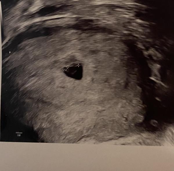 Bild zu Ramzi Methode Junge oder Mädchen - Schwanger - wer noch? Rund um die Schwangerschaft