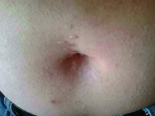 Bild zu Kommt der Nabel noch raus - Schwanger - wer noch? Rund um die Schwangerschaft