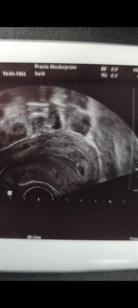 Bild zu Zwillinge - Schwanger - wer noch? Rund um die Schwangerschaft
