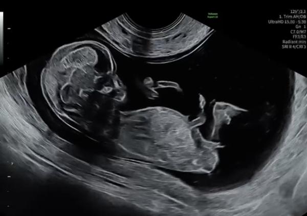 Bild zu Junge oder Mädchen - Schwanger - wer noch? Rund um die Schwangerschaft