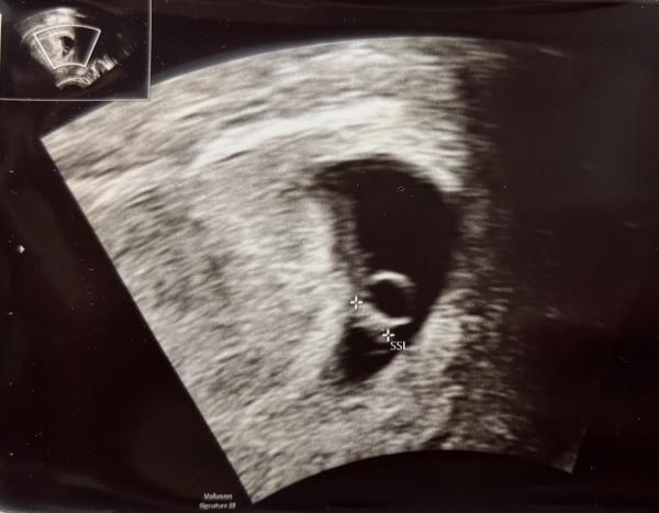 Bild zu Mädchen oder Junge - Frage an die Ramzi Experten - Schwanger - wer noch? Rund um die Schwangerschaft