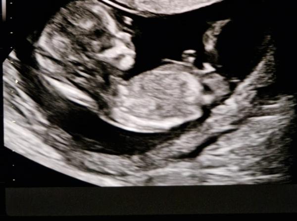 Bild zu Junge oder Mädchen - Schwanger - wer noch? Rund um die Schwangerschaft