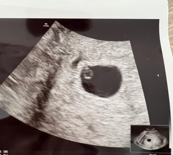 Bild zu Ramzi Methode hilfe - Schwanger - wer noch? Rund um die Schwangerschaft