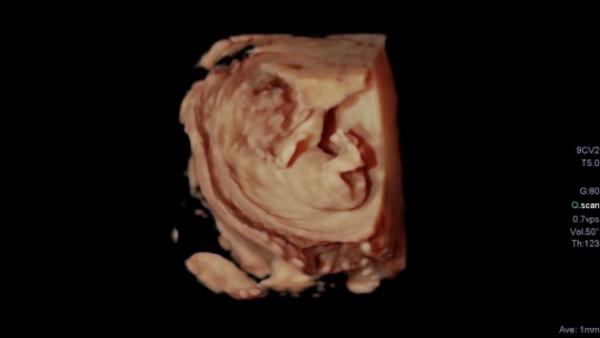 Bild zu Vermutungen Jung oder Mädchen ? - Schwanger - wer noch? Rund um die Schwangerschaft