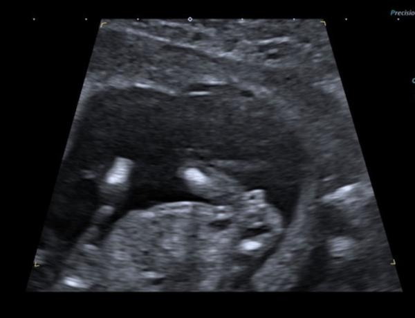 Bild zu Vermutungen Jung oder Mädchen ? - Schwanger - wer noch? Rund um die Schwangerschaft