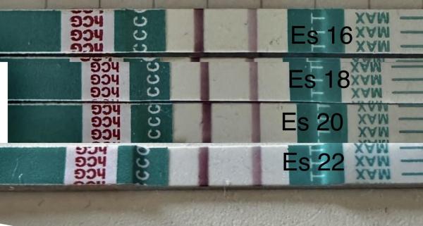 Bild zu Steigerung erkennbar? - Kinderwunsch nach Fehlgeburt