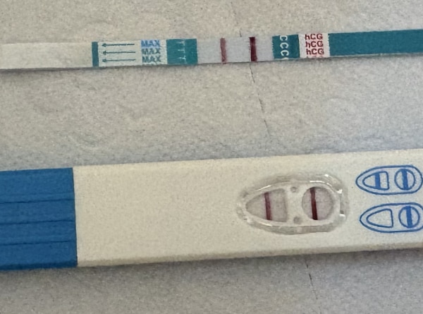 Bild zu Direkt schwanger nach Fehlgeburt? - Kinderwunsch nach Fehlgeburt