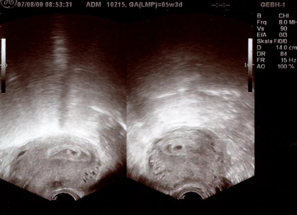 Bild zu Achtung, Mädels !!          *****V---I---R---E---N***** - Kinderwunsch - bitte noch ein Baby