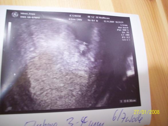 Bild zu Jetzt gibt es wieder VIREN - Kinderwunsch - bitte noch ein Baby