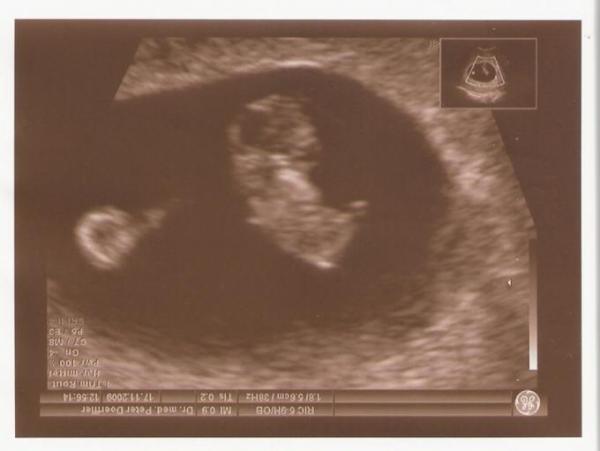 Bild zu Viiiiiiiiirrrrrrrrreeeeeeeen - Kinderwunsch - bitte noch ein Baby