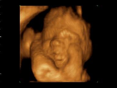 Bild zu Hoffe es kommt nicht blöd rüber... - Kinderwunsch - bitte noch ein Baby