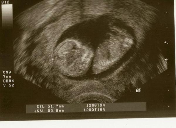 Bild zu Eine Portion Mut für euch! - Kinderwunsch - bitte noch ein Baby
