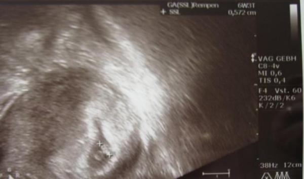 Bild zu Jetzt gibst endlich VIIIIIREN - Kinderwunsch - bitte noch ein Baby