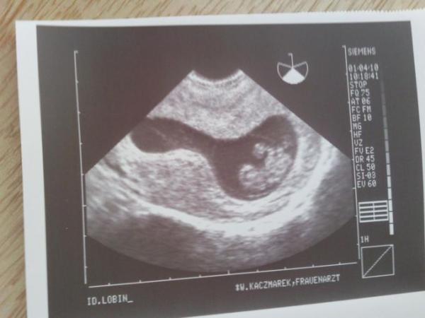 Bild zu Mädels............. - Kinderwunsch - bitte noch ein Baby