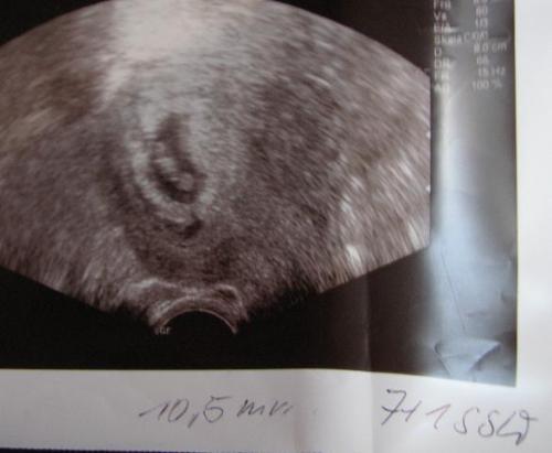 Bild zu Ich verabschiede mich ganz offiziell! - Kinderwunsch - bitte noch ein Baby