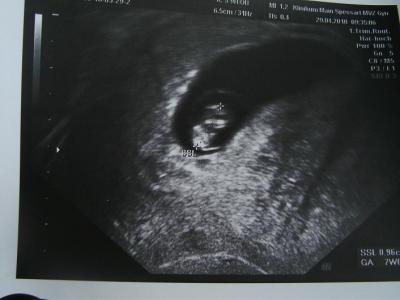 Bild zu antreten zum saugen !!!!! - Kinderwunsch - bitte noch ein Baby