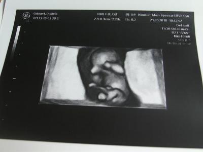 Bild zu WOW..... - Kinderwunsch - bitte noch ein Baby