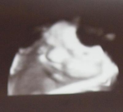Bild zu Hab lange überlegt...... - Kinderwunsch - bitte noch ein Baby