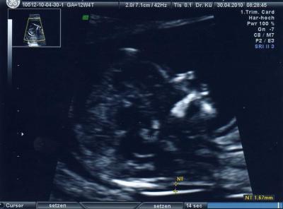 Bild zu Wollte mich mal bei euch melden - Kinderwunsch - bitte noch ein Baby