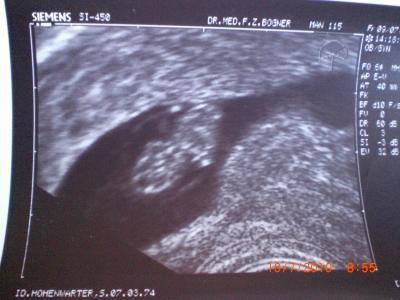 Bild zu Viiiiren! - Kinderwunsch - bitte noch ein Baby