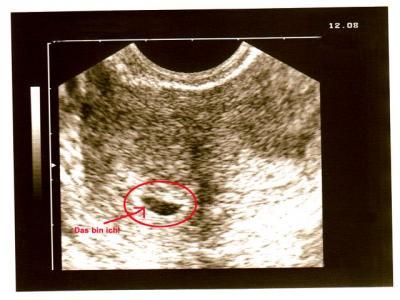 Bild zu VIREN für ALLE! - Kinderwunsch - bitte noch ein Baby