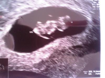 Bild zu Jetzt gibts VIIIIIIIIIIIIIIIIIIIREEEEENNNNN :-))))))) - Kinderwunsch - bitte noch ein Baby