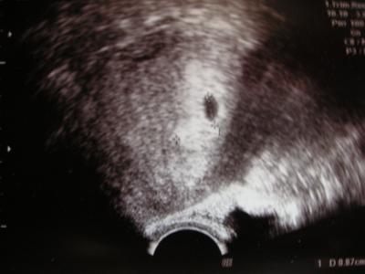 Bild zu Gute Neuigkeiten :)) - Kinderwunsch - bitte noch ein Baby