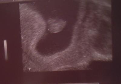 Bild zu Ich habe die Viren :-) - Kinderwunsch - bitte noch ein Baby